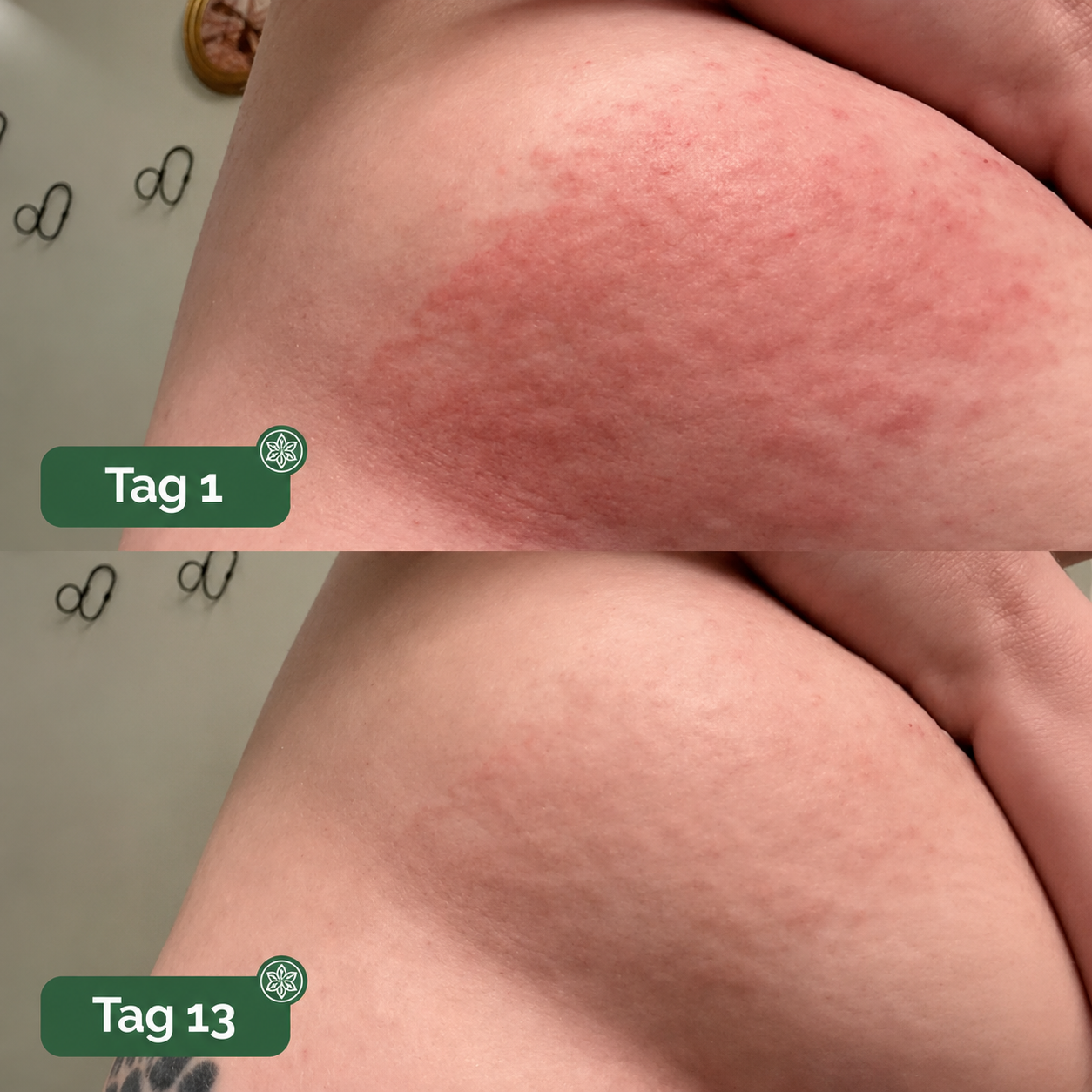 "GR" undercareskin