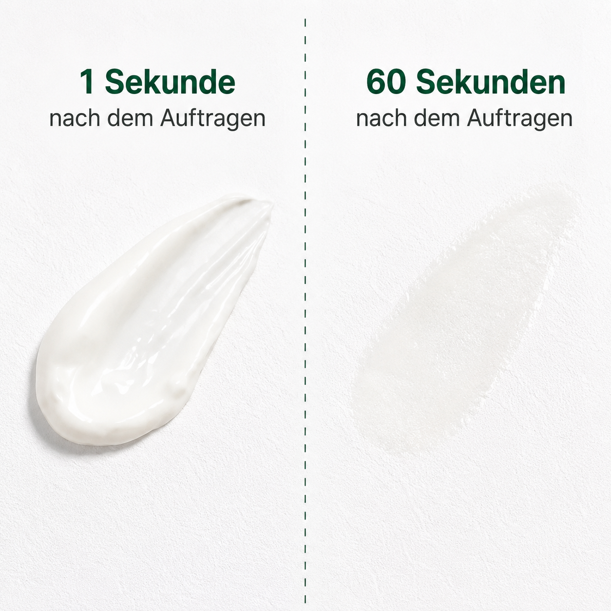 "GR" undercareskin