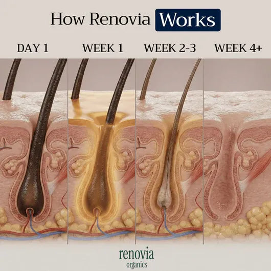 Renovia